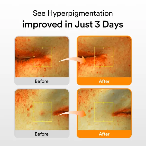 Abib Glutathiosome dark spot serum Vita drop 50ml  169 floz  Korean Skincare Dark Spot Hyperpigmentation Treatment  Brightening Serum for Sensitive Uneven Skin  Niacinamide Viatmin C
